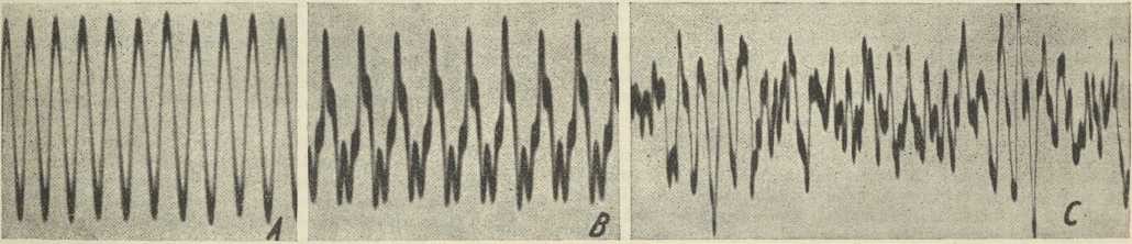 sl. 2. Oscilogrami zvučnih titraja. <i>A</i> jednostavan titraj; <i>B, C</i> sastavljeni titraji (<i>B</i> za zvuk, <i>C</i> za šum)